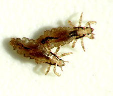 head lice picture by Eran Finkle head lice picture by Eran Finkle